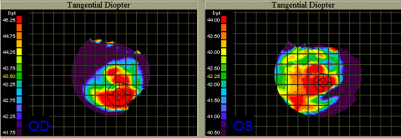 Case 2 topography.