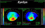 eyesys14.jpg (124148 bytes)